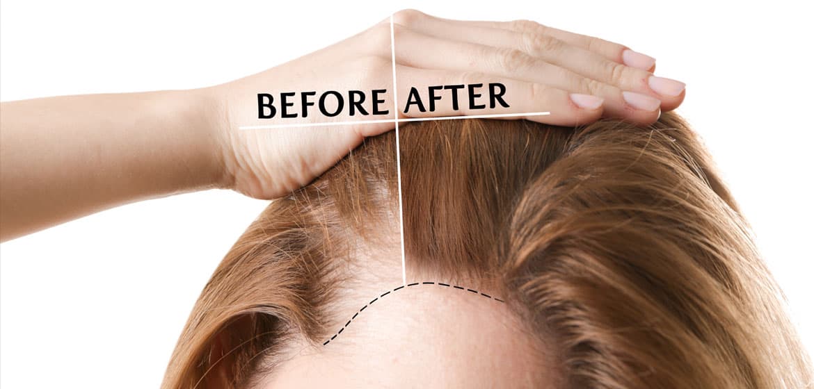 Sapphire Hair Clinic – Professional Hair Transplant Istanbul