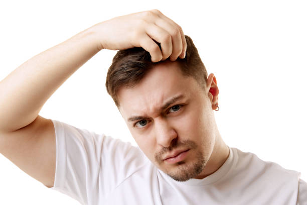 How Much Is Hair Transplant for International Patients?